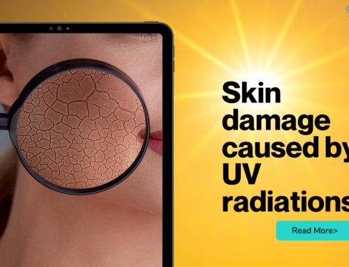 Skin damage caused by UV radiation